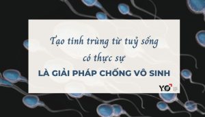 Thumb Yo 700 × 400 px 1