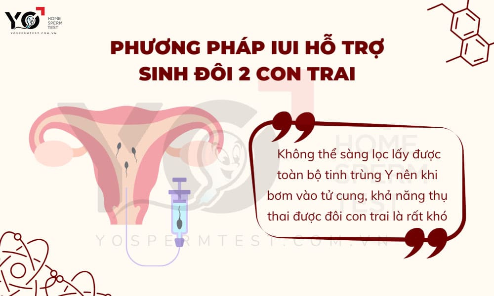 Sinh 2 trai bằng phương pháp IUI