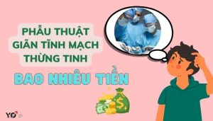 mo gian tinh mach thung tinh bao nhieu tien