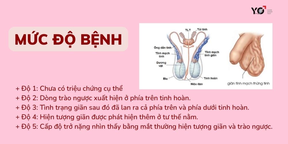 mức độ bệnh mổ giãn tĩnh mạch thừng tinh