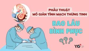 phau thuat mo gian tinh mach thung tinh