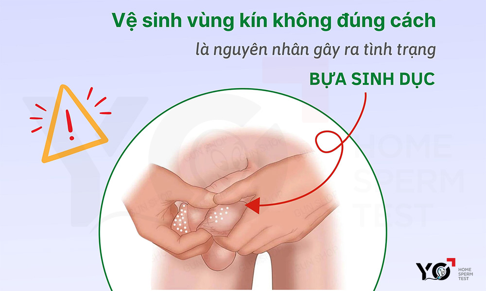 Vệ sinh dương vật không đúng cách là nguyên nhân gây ra tình trạng bựa sinh dục