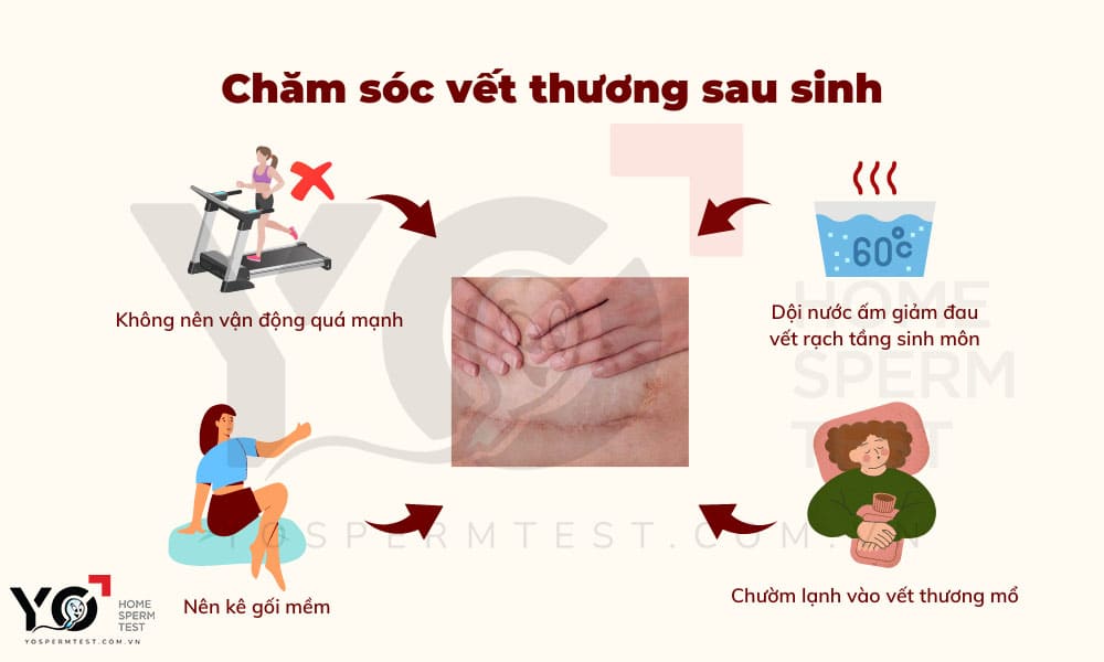 Chăm sóc vết thương sau sinh thật kỹ lưỡng