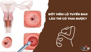 Thumb Yo 700 × 400 px 1
