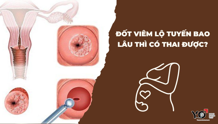 Thumb Yo 700 × 400 px 1