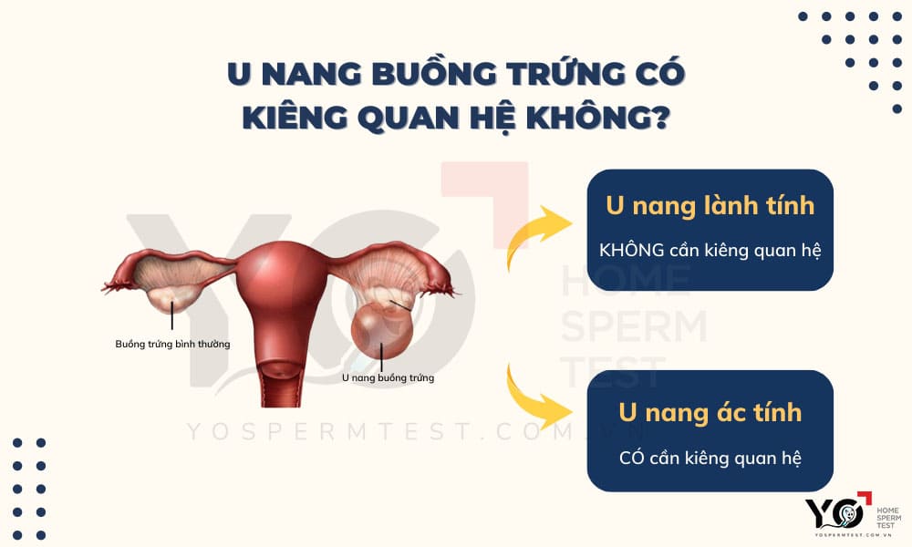 U nang buồng trứng có cần kiêng quan hệ