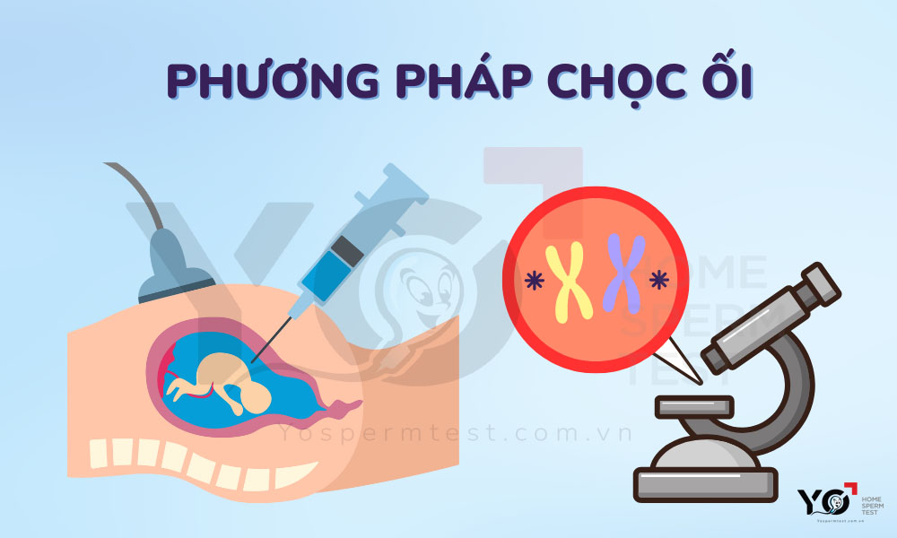 Phương pháp chọc ối có xâm lấn vào bên trong làm tăng 1% tỉ lệ sảy thai
