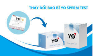 bao-bi-moi-yo-sperm-test-1